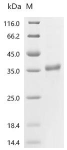 Human Cathepsin G (CTSG) Recombinant Protein, C-His, aa 21–255, Baculovirus, Homo sapiens (Human), Baculovirus, C-terminal 6xHis-tagged, 27.8 kDa, purity >≥ 95% as determined by SDS-PAGE.