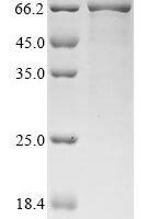 Yersinia pestis Putative accessory processing protein (hmwC), partial Recombinant Protein - BioCrest Sci