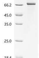 Human Acyloxyacyl hydrolase (AOAH) Recombinant Protein, N-His-SUMO - BioCrest Sci