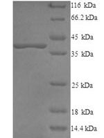 Bovine Decorin (DCN) Recombinant Protein - BioCrest Sci