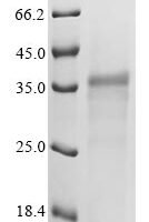 Mouse Leukocyte cell-derived chemotaxin-2 (Lect2) Recombinant Protein - BioCrest Sci