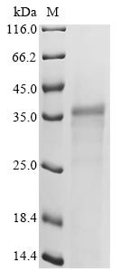 Mouse Leukocyte cell-derived chemotaxin-2 (Lect2) Recombinant Protein, Mus musculus (Mouse), Yeast, C-terminal 6xHis-Myc-tagged, 18.4 kDa, purity >≥ 90% as determined by SDS-PAGE.