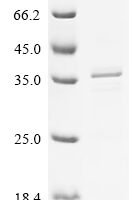 Sus scrofa Platelet-derived growth factor subunit B Recombinant Protein, N-His - BioCrest Sci