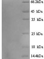 Guinea pig Saposin-C (PSAP) Recombinant Protein - BioCrest Sci