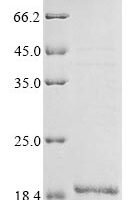 Influenza A virus Matrix protein 2 (M), partial Recombinant Protein, N-10His/C-Myc - BioCrest Sci