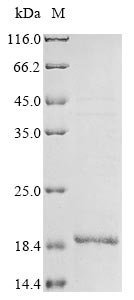 Influenza A virus Matrix protein 2 (M), partial Recombinant Protein, N-10His/C-Myc, Influenza A virus (strain A/Puerto Rico/8/1934 H1N1), E.coli, N-terminal 10xHis-tagged and C-terminal Myc-tagged, 13.8 kDa, purity >≥ 85% as determined by SDS-PAGE.