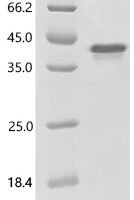 Human BCL2/adenovirus E1B 19 kDa protein-interacting protein 3-like (BNIP3L), partial Recombinant Protein - BioCrest Sci