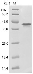 Human BCL2/adenovirus E1B 19 kDa protein-interacting protein 3-like (BNIP3L), partial Recombinant Protein, E.coli, C-terminal 6xHis-tagged, 27.4 kDa, purity >≥ 95% as determined by SDS-PAGE.