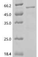 Human Ectonucleoside triphosphate diphosphohydrolase 1 (ENTPD1), partial Recombinant Protein - BioCrest Sci