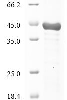Human Leucine-rich repeat-containing protein 17 (LRRC17), partial Recombinant Protein - BioCrest Sci