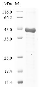 Human Leucine-rich repeat-containing protein 17 (LRRC17), partial Recombinant Protein, Homo sapiens (Human), E.coli, N-terminal 6xHis-KSI-tagged, 42.2 kDa, purity >≥ 85% as determined by SDS-PAGE.