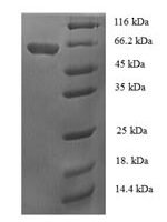 Bacillus subtilis Alpha-galactosidase (melA) Recombinant Protein, N-His-SUMO - BioCrest Sci