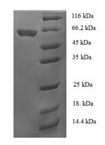 Bacillus subtilis Alpha-galactosidase (melA) Recombinant Protein, N-His-SUMO, Bacillus subtilis (strain 168), E.coli, N-terminal 6xHis-SUMO-tagged, 65.3 kDa, purity >≥ 90% as determined by SDS-PAGE.