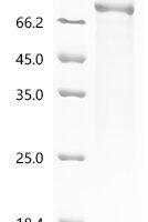 Human DNA polymerase theta (POLQ), partial Recombinant Protein, N-His - BioCrest Sci