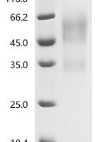 Mouse Tumor necrosis factor receptor superfamily member 16 (Ngfr), partial Recombinant Protein, N-His - BioCrest Sci