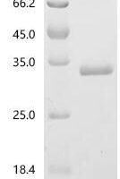 Human Thrombospondin type-1 domain-containing protein 7A (THSD7A), partial Recombinant Protein - BioCrest Sci