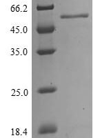 Influenza A virus Nucleoprotein (NP) Recombinant Protein, N-His, aa 1–498, strain A/Equine/Prague/1/1956 H7N7 - BioCrest Sci