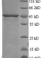 Human SWI/SNF-related matrix-associated actin-dependent regulator of chromatin subfamily B member 1 (SMARCB1), partial Recombinant Protein, N-His, aa 2–376, Yeast - BioCrest Sci