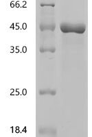 Simian retrovirus SRV-2 Envelope glycoprotein (env), partial Recombinant Protein - BioCrest Sci
