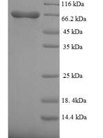 Chamaecyparis obtusa Polygalacturonase Recombinant Protein, N-His-SUMO - BioCrest Sci