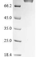 Mouse Serine protease inhibitor A3K (Serpina3k) Recombinant Protein, C-hFc1 - BioCrest Sci