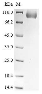 Mouse Serine protease inhibitor A3K (Serpina3k) Recombinant Protein, C-hFc1, Mus musculus (Mouse), Mammalian cell, C-terminal hFc1-tagged, 73.7 kDa, purity >≥ 90% as determined by SDS-PAGE.
≥ 90% as determined by SEC-HPLC.