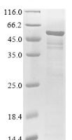Human Ribitol-5-phosphate transferase FKTN (FKTN) Recombinant Protein - BioCrest Sci