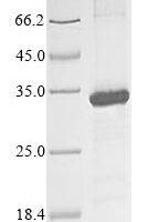 Human Killer cell immunoglobulin-like receptor 2DS3 (KIR2DS3), partial Recombinant Protein, N-10His/C-Myc - BioCrest Sci