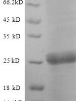 Saccharomyces cerevisiae Neutral trehalase (NTH1), partial Recombinant Protein, N-His, aa 546–751 - BioCrest Sci