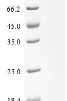 Japanese encephalitis virus Envelope protein (E), Partial Recombinant Protein - BioCrest Sci