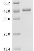 Neisseria gonorrhoeae Glyceraldehyde-3-phosphate dehydrogenase (gapA) Recombinant Protein - BioCrest Sci