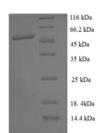 Human PRKCA-binding protein (PICK1), partial Recombinant Protein - BioCrest Sci