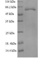 Thermus aquaticus DNA polymerase I, thermostable (polA), partial Recombinant Protein, N-GST, aa 287–832 - BioCrest Sci
