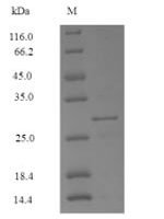Mercurialis annua Profilin Recombinant Protein, N-His-SUMO - BioCrest Sci