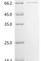 Dog Werner syndrome ATP-dependent helicase isoform X2, partial Recombinant Protein - BioCrest Sci