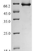 Human Endogenous retrovirus group K member 6 Env polyprotein (ERVK-6), partial Recombinant Protein, N-10His - BioCrest Sci