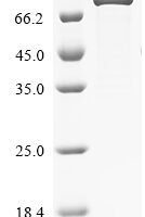 Human Zinc finger protein 74 (ZNF74) Recombinant Protein - BioCrest Sci