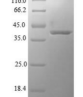 Human 3-hydroxyacyl-CoA dehydrogenase type-2 (HSD17B10) Recombinant Protein - BioCrest Sci