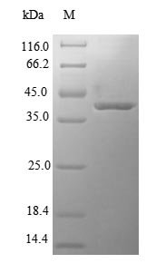 Human 3-hydroxyacyl-CoA dehydrogenase type-2 (HSD17B10) Recombinant Protein, Homo sapiens (Human), E.coli, N-terminal 6xHis-SUMO-tagged, 42.8 kDa, purity >≥ 90% as determined by SDS-PAGE.