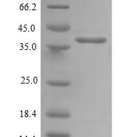 Human Mitochondrial import inner membrane translocase subunit TIM14 (DNAJC19) Recombinant Protein - BioCrest Sci