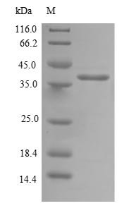 Human Mitochondrial import inner membrane translocase subunit TIM14 (DNAJC19) Recombinant Protein, Homo sapiens (Human), E.coli, N-terminal GST-tagged, 39.5 kDa, purity >≥ 90% as determined by SDS-PAGE.