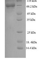 Human Calpastatin (CAST) Recombinant Protein, N-His, aa 1–667, E.coli - BioCrest Sci