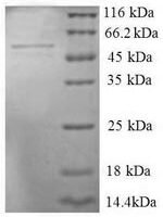 human Seryl-tRNA synthetase,Cytoplasmic domain protein (SERS), partial Recombinant Protein - BioCrest Sci
