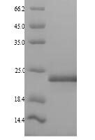 Human Mediator of DNA damage checkpoint protein 1 (MDC1), partial Recombinant Protein, N-His - BioCrest Sci