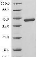 Human Nucleoside diphosphate kinase, mitochondrial (NME4) Recombinant Protein - BioCrest Sci