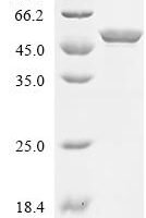 Escherichia coli Histidine--tRNA ligase (hisS) Recombinant Protein - BioCrest Sci