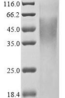 Mouse Tripeptidyl-peptidase 2 (Tpp2), partial Recombinant Protein - BioCrest Sci