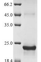 Human variant SIRP alpha (SIRPA) Recombinant Protein - BioCrest Sci
