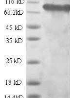 Rat Integrin beta-1 (Itgb1), partial Recombinant Protein - BioCrest Sci
