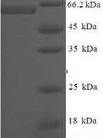 Human Protein ERGIC-53-like (LMAN1L) Recombinant Protein, N-His-SUMO - BioCrest Sci
